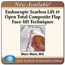 Scarless Endoscopic and Open Composite Plane Face-Lifting Techniques 2025