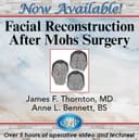 Facial Reconstruction After Mohs Surgery (2024)