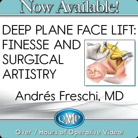 Deep Plane Face Lift: Finesse and Surgical Artistry (2023)