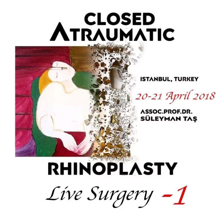 Closed Atraumatic Rhinoplasty – Live Surgery #1 2018 