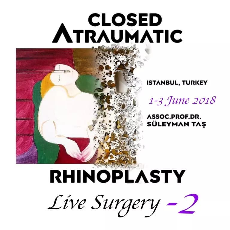 Closed Atraumatic Rhinoplasty – Live Surgery #2 2018