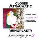 Closed Atraumatic Rhinoplasty – Live Surgery #2 2018