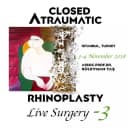 Closed Atraumatic Rhinoplasty – Live Surgery #3 2018