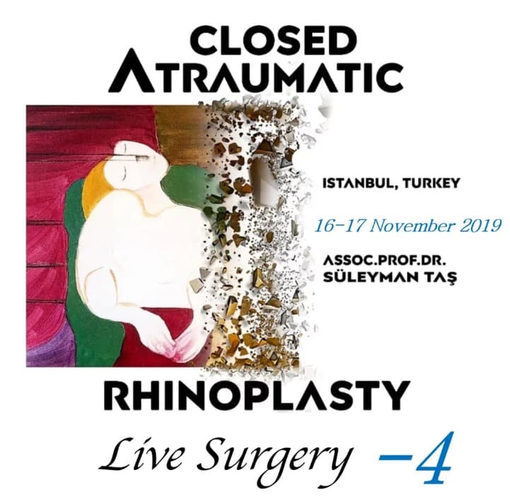Closed Atraumatic Rhinoplasty – Live Surgery 2019