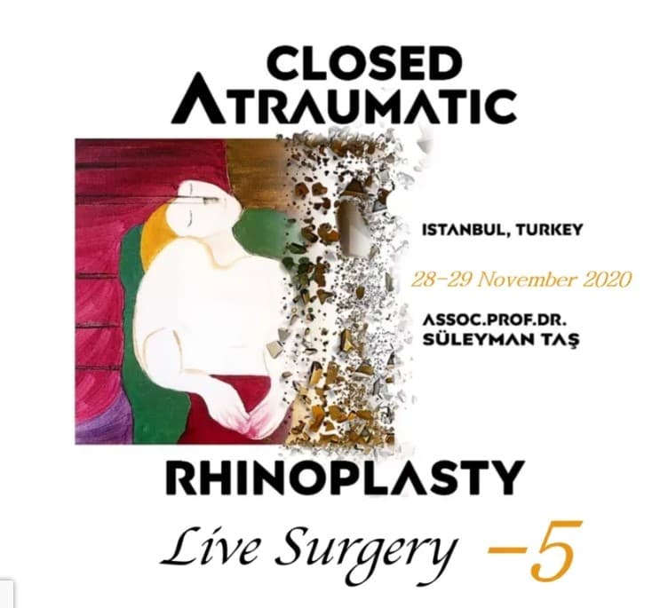 Closed Atraumatic Rhinoplasty – Live Surgery 2020