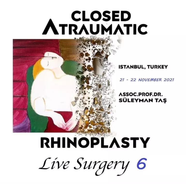 Closed Atraumatic Rhinoplasty – Live Surgery 2021