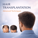 Hair Transplantation