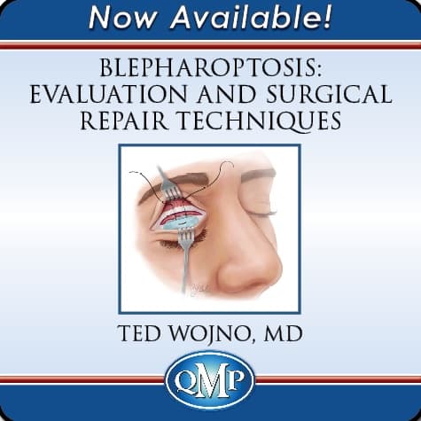 Blepharoptosis: Evaluation and Surgical Repair Techniques